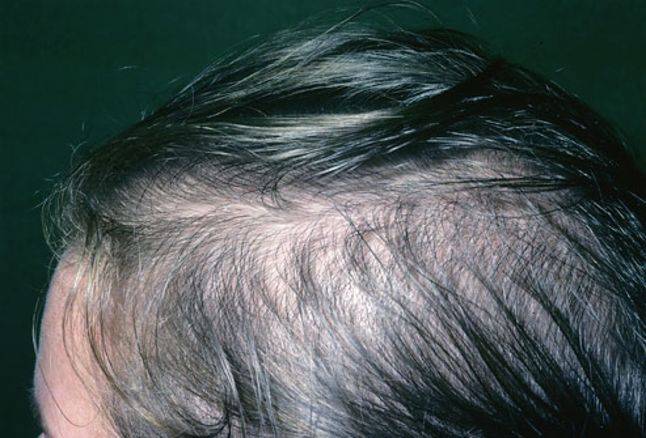 Лечение выпадения волос у животных чего нет