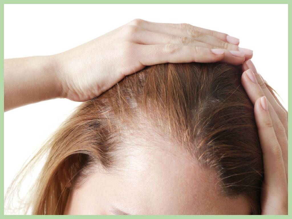 Как остановить облысение и восстановить волосы у женщин