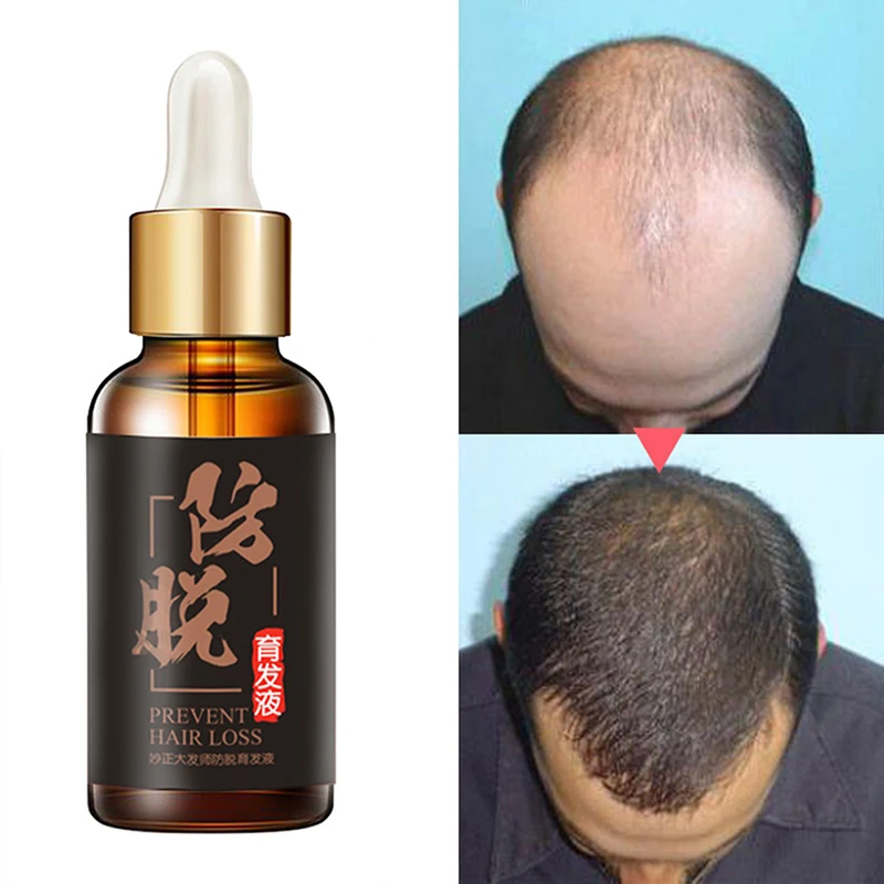 Китайское народное средство от выпадения волос