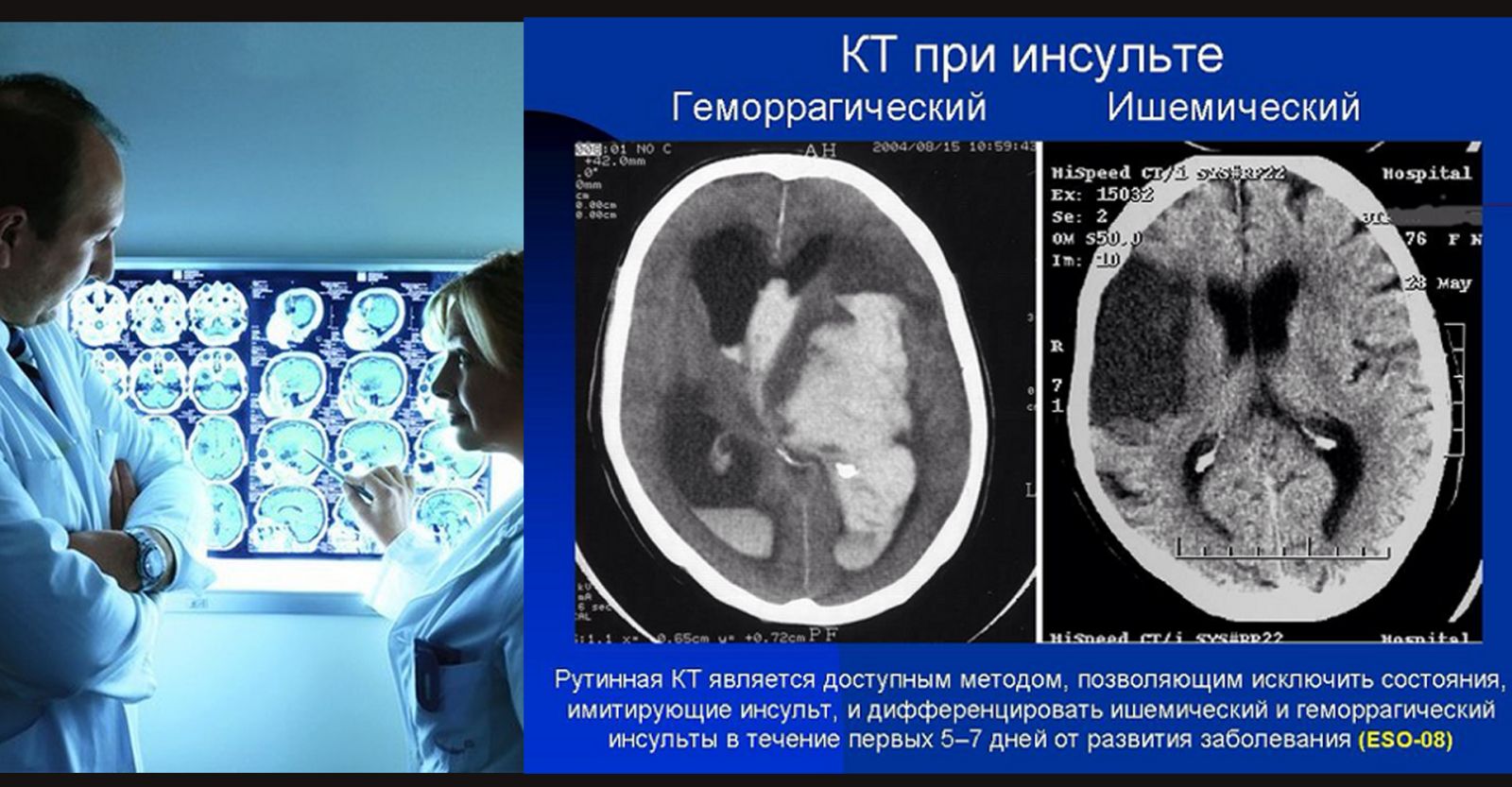 Мрт дифференциальная диагностика