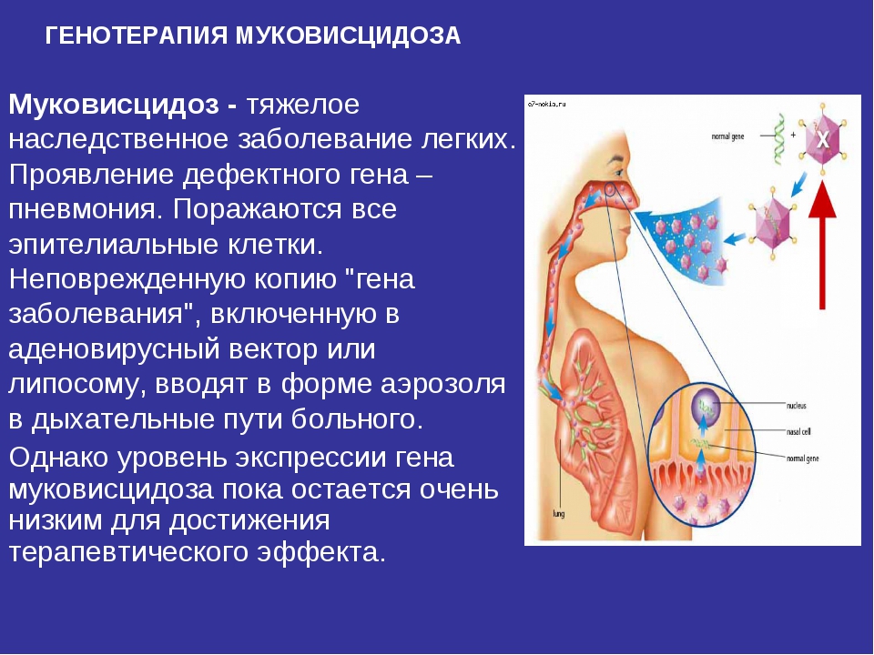 Фиброз что это за болезнь симптомы и лечение у мужчин фото