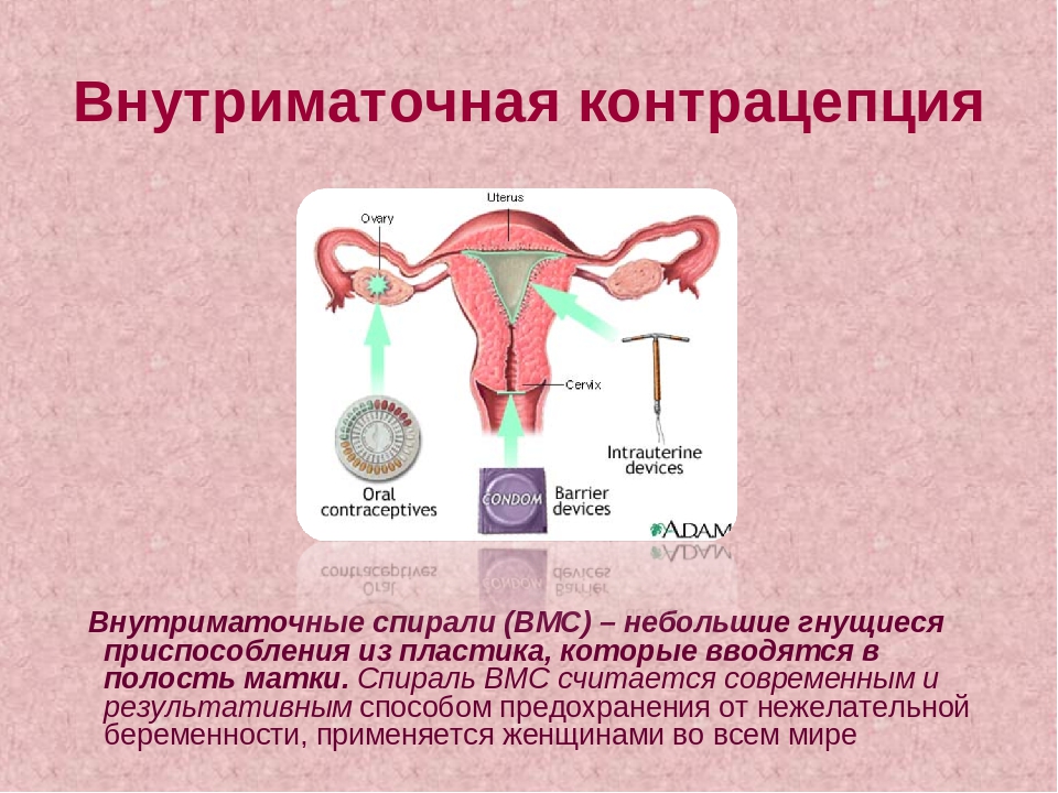 Внутриматочная концентрация презентация