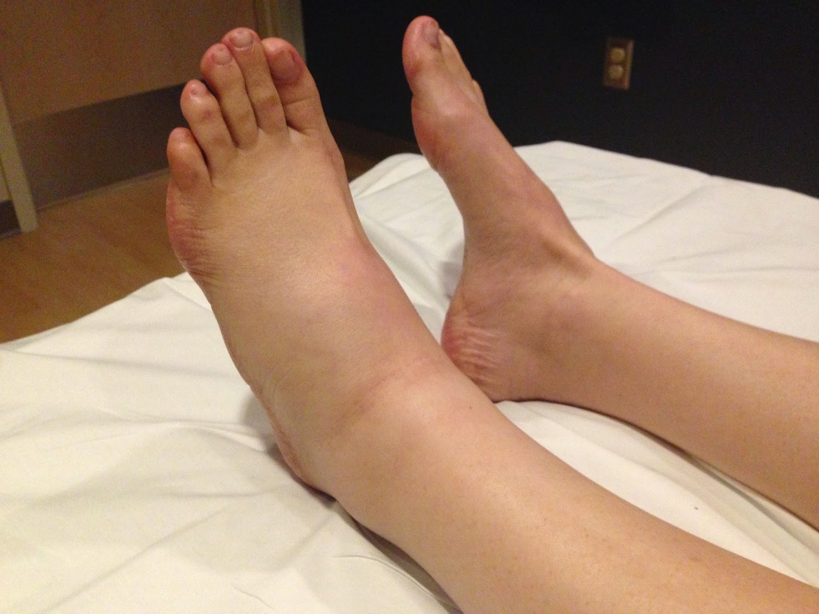 фото болезней ног