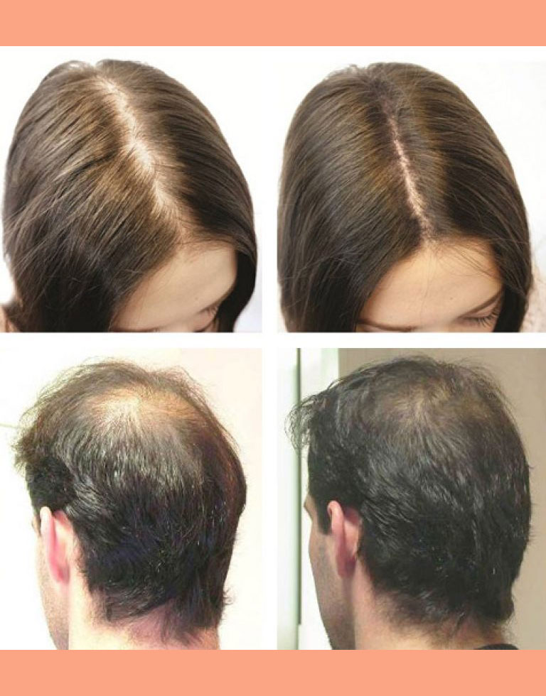 Обновление волос на голове сколько длится у женщин