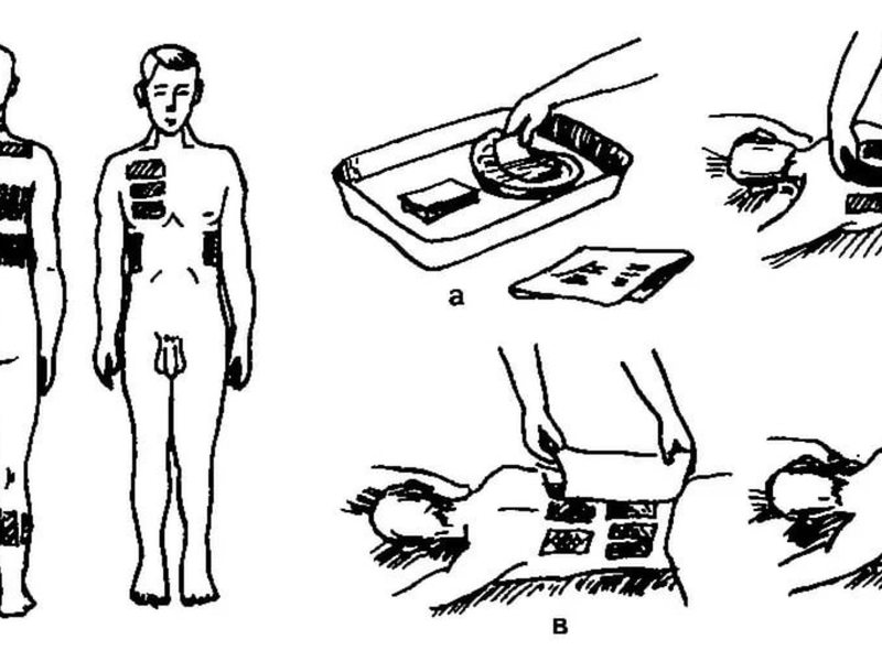 Горчичники на спину схема