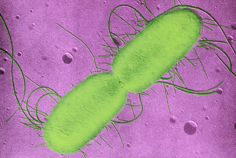 Coli sotwe. Кишечная палочка Escherichia coli. Эшерихии кишечная палочка. Escherichia coli эшерихии. Кишечная палочка o157.